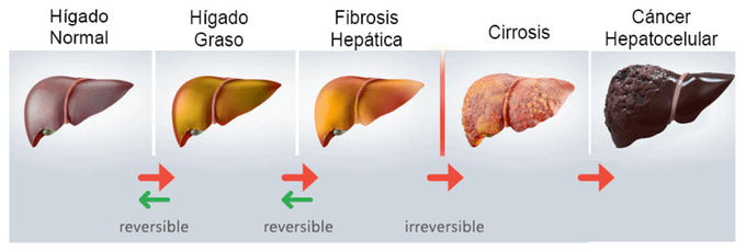 Progresión hepática